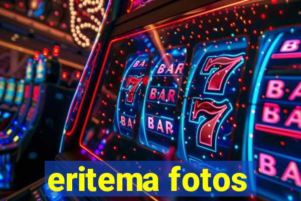 eritema fotos