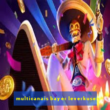 multicanais bayer leverkusen